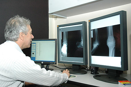 En el mundo se realizan más de 500.000 amputaciones de pie diabético al año.
