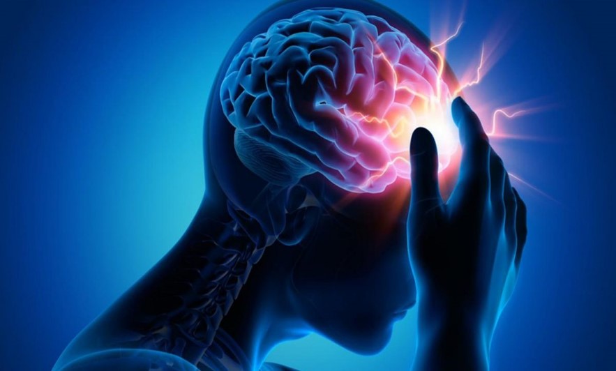 Accidente cerebrovascular la clave es identificarlo y actuar a tiempo Accidente cerebrovascular la clave es identificarlo y actuar a tiempo